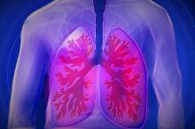 UGR scientists improve the diagnosis and treatment of lung cancer